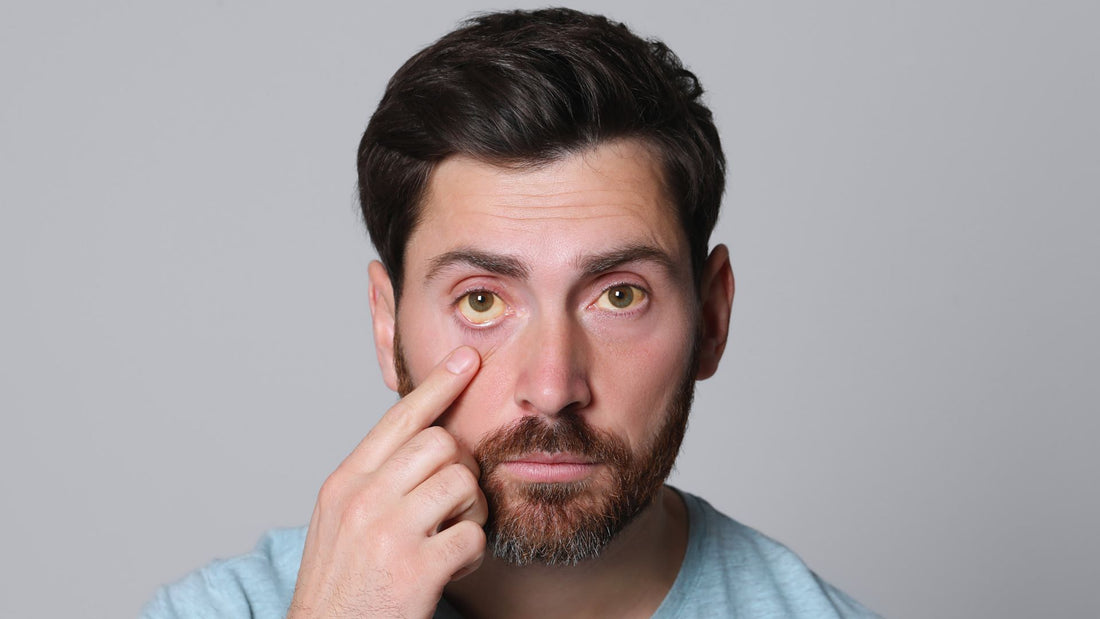 eye infection, eye infection types, eye infection causes, eye infection tretments